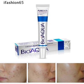Ifashion65 Face Skin Care Acne Shrink Pore Scar Remove Oil Control Moisturizing Face Cream CL
