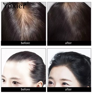 [mbn] yoxier aceite esencial de crecimiento de hierbas champú cuidado del cabello peinado pérdida de cabello.