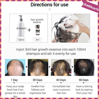suero de crecimiento del cabello esencia aceite anti pérdida rebrote tratamiento para hombres (2)