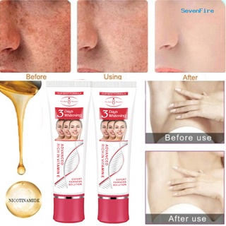 sevenfire 25/50g corrector de manchas oscuras hidratante crema facial eliminación de manchas cuidado de la piel