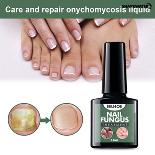 SW 15ml Nail Fungal Treatment Nail Care Onychomycosis Removal Antibacterial Nail Repair Solution Liquid Foot Care (1)