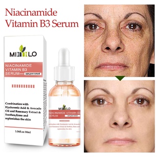 nicotinamida esencia hidratante niacina ácido revitalizante iluminar blanqueamiento hidratante anti-envejecimiento arrugas