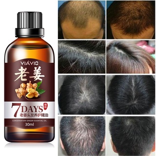 30ml eficaz crecimiento del cabello ungüento cuidado del cabello saludable crecimiento esencia aceite earound (6)