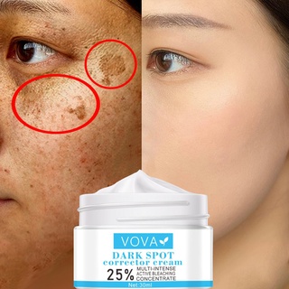 Freckle Fading Cream Effective Remove Melasma Stain Pigment Melanin Dark Spots (1)