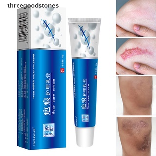 [threegoodstones] crema de eliminación de cicatrices de acné espinillas estrías gel facial eliminar acné suavizante caliente