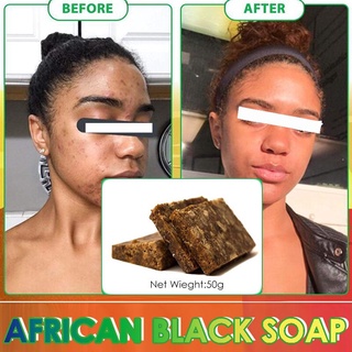 Natural Cuerpo Mágico Africano Negro Jabón Blanqueamiento Aclarador Crema Resultados Rápidos Ácido Kojic Para Piel Oscura 50g