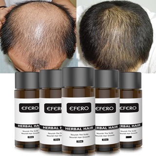 engfeimi efero potente jengibre barba crecimiento del cabello esencia anti pérdida aceite control suero