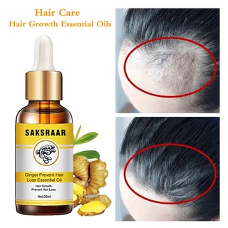 chaiopi 20ml aceite de crecimiento del cabello no irritante acelerar crecimiento extracto natural cuidado del cabello aceites esenciales pérdida original líquido para unisex (1)
