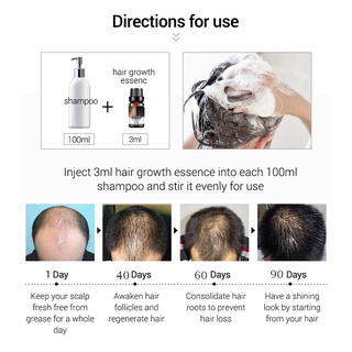 engfeimi 10ml equilibrio de aceite para el cabello secreción de sebo multifuncional extractos de plantas de crecimiento del cabello esencia del cuero cabelludo para salón (8)