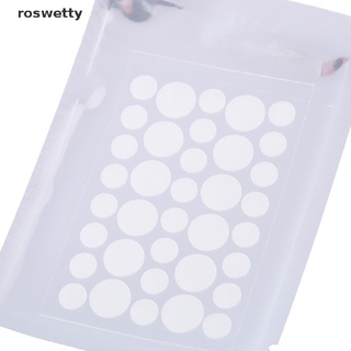 Roswetty 108pcs Skin Tag Remover Patch Hydrocolloid Acne Pimples Moles Zits Warts CL (2)