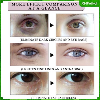 15ml crema de ojos anti envejecimiento removedor de hinchazón tratamiento de cuidado de los ojos para hombres mujeres