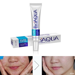 ganjou BIOAQUA Acne Scar Treatment Removal Cream Moisturizing Oil Control Skin Care