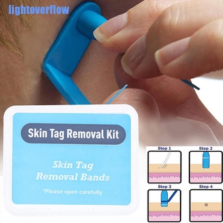 [lof] 20 bandas de goma para eliminar la piel, micro banda, no tóxica, para el cuidado de la cara, verruga