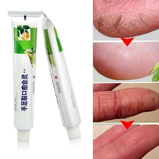 [fa]potente mano pie crema de grietas talón agrietado peeling cuidado de la piel chino ungüento (1)