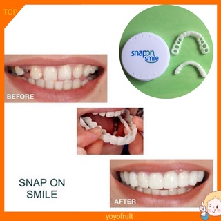 Yoyo - juego de 2 dientes de dentadura superior, diseño de sonrisa Natural, cubierta de dentadura, dientes, carillas cosméticas para clínica Dental