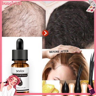 ♚ 20ML Hair Care Hair Growth Essential Oils Essence Grow Hair Fluid Essense Oil