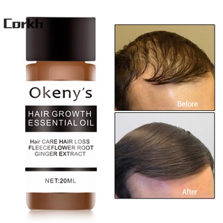 Corkh aceite esencial Natural cuero cabelludo acondicionador de cabello aceite esencial no graso para hombres (2)