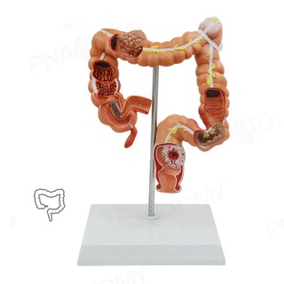 Teaching el Human Large Intestine Anatomical el Visceral Colon and Rectum Pathological el for School Hospital (4)