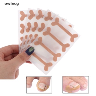 owincg 5 hojas de uñas de los pies banda ayuda corrección pedicura pegatina elástica vendaje del dedo del pie uñas cl