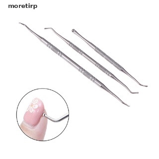 moretirp 1 pza herramienta para el cuidado de los pies/removedor de suciedad/removedor de suciedad para podología/pedicura cl