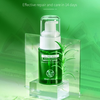 chaiopi 30ml acné eliminar suero aliviar acné agua aceite equilibrio planta extractos árbol de té acné eliminar suero para niña (1)