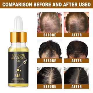 geanmiu 20ml acondicionador de crecimiento del cabello universal multifuncional fácil de usar para el cuidado del cabello aceite esencial para hombres (6)