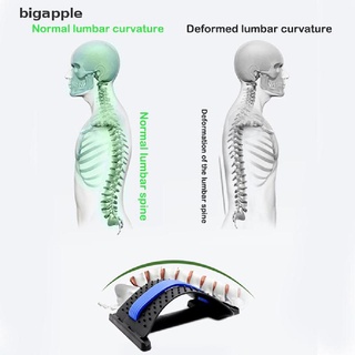 [bigapple] Equipo de estiramiento de espalda/ensanchador/Fitness/soporte Lumbar/alivio del dolor de columna