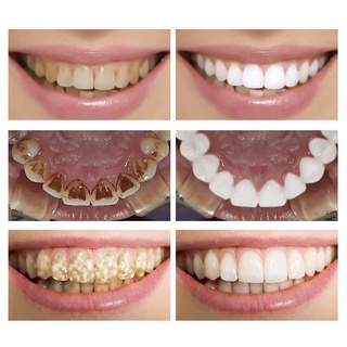10ml esencia blanqueadora dental higiene oral eliminar manchas de dientes eficaz
