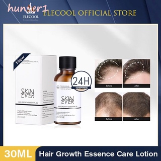 hunter Hair Growth Essential Oil Plant Extract Scalp Care Solution Ginseng Polygonum Multiflorum Extract Nourishes the Scalp hunter